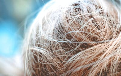 Capillus – A Look at Hairloss Treatment for Women