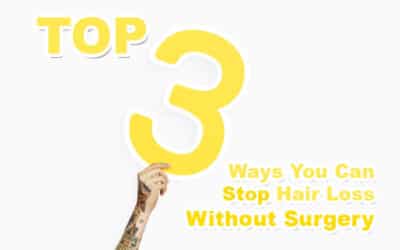 The Top 3 Ways You Can Stop Hair Loss Without Surgery