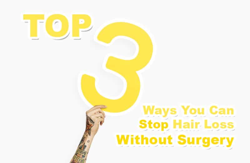 Top 3 ways to stop hair loss without surgery