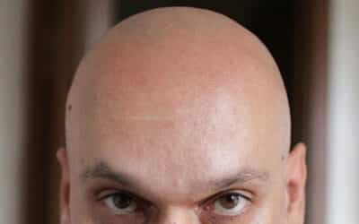 The Capillus 312 RX Laser Cap Can Help You Restore Your Lost Hair
